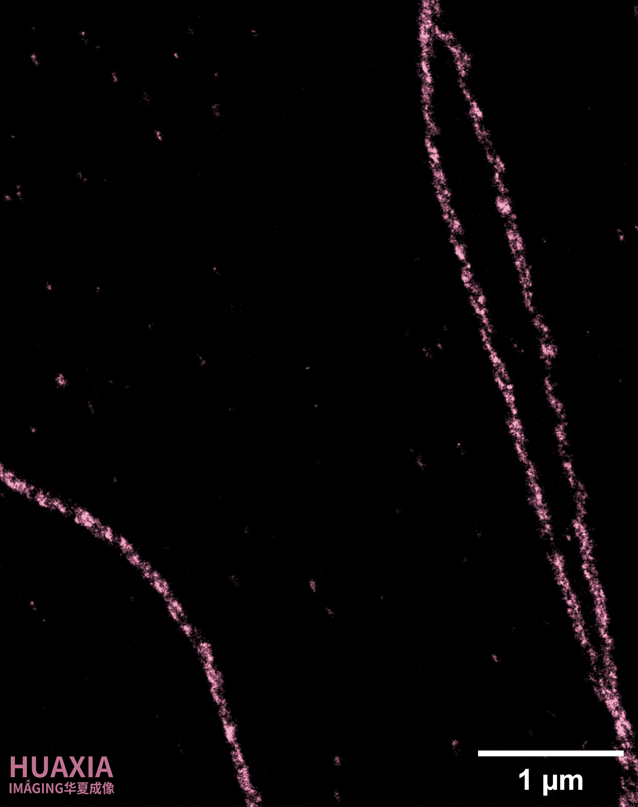 STORM 实测数据，标尺 1 微米